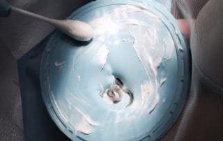 non latex rubber dam